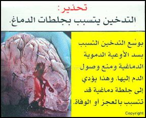 Djibouti 2009 Health Effects stroke - diseased organ, brain, stroke, gross - Arabic